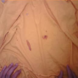 Defect Image