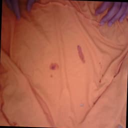 Defect Image
