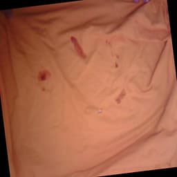 Defect Image